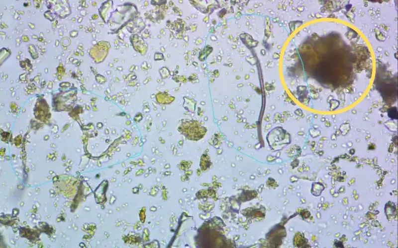 Why Fruit Trees Struggle - and What Helps Them Thrive. Derek describes these tiny soil aggregates as little “castles” (circled in yellow). Built from soil particles and organic matter held together by microbial activity, they are part of the structure that makes healthy soil such a remarkable living environment. Photo credit: Derek Barbe.